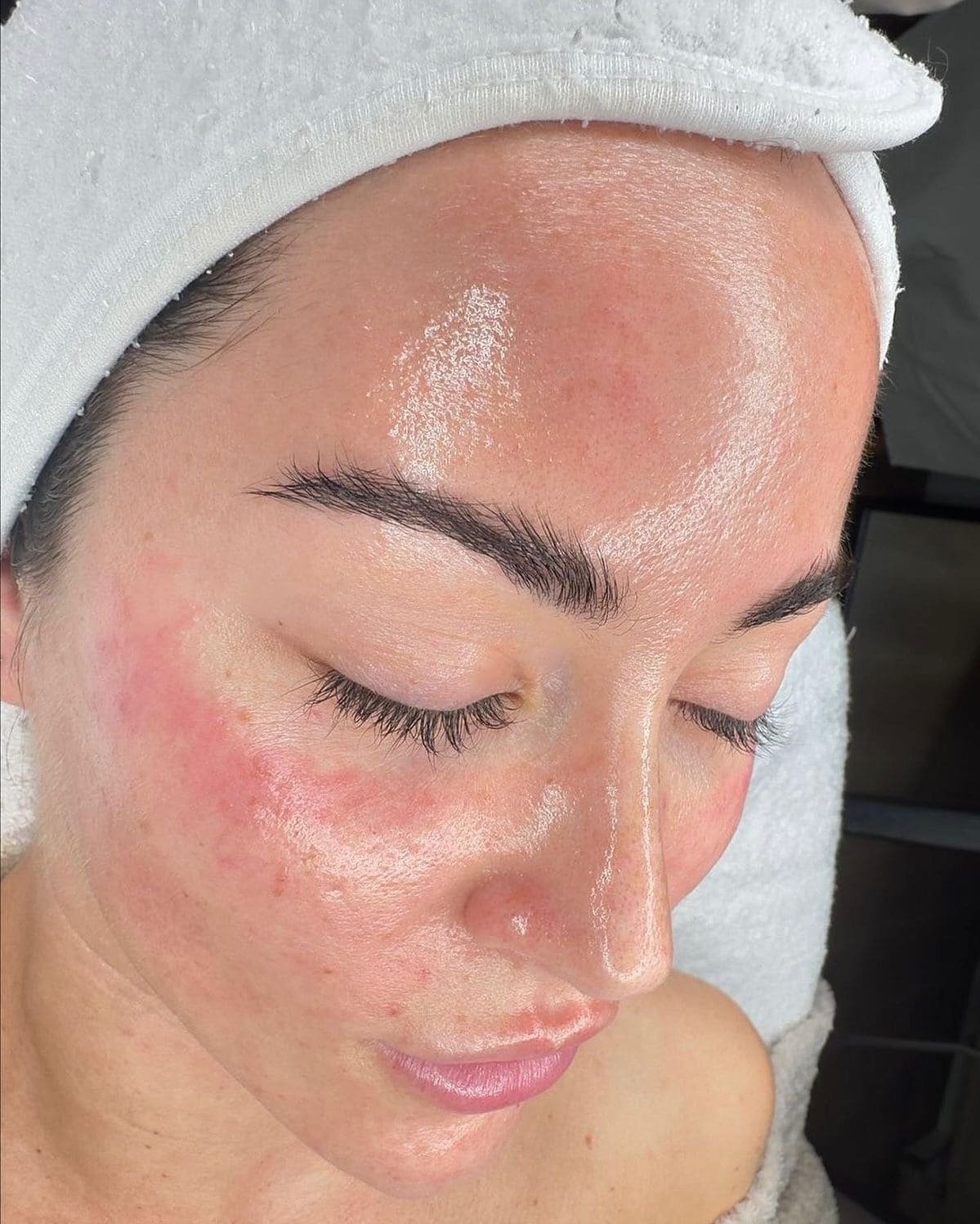 Tratamiento Hydrodiamond 