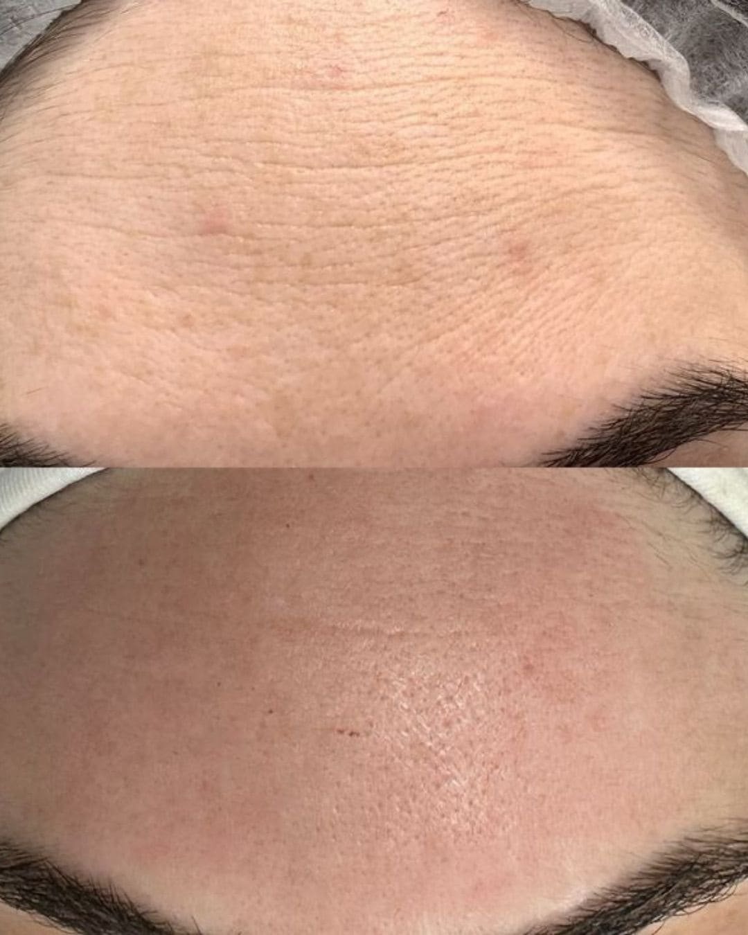 Skin Radiant Lifting