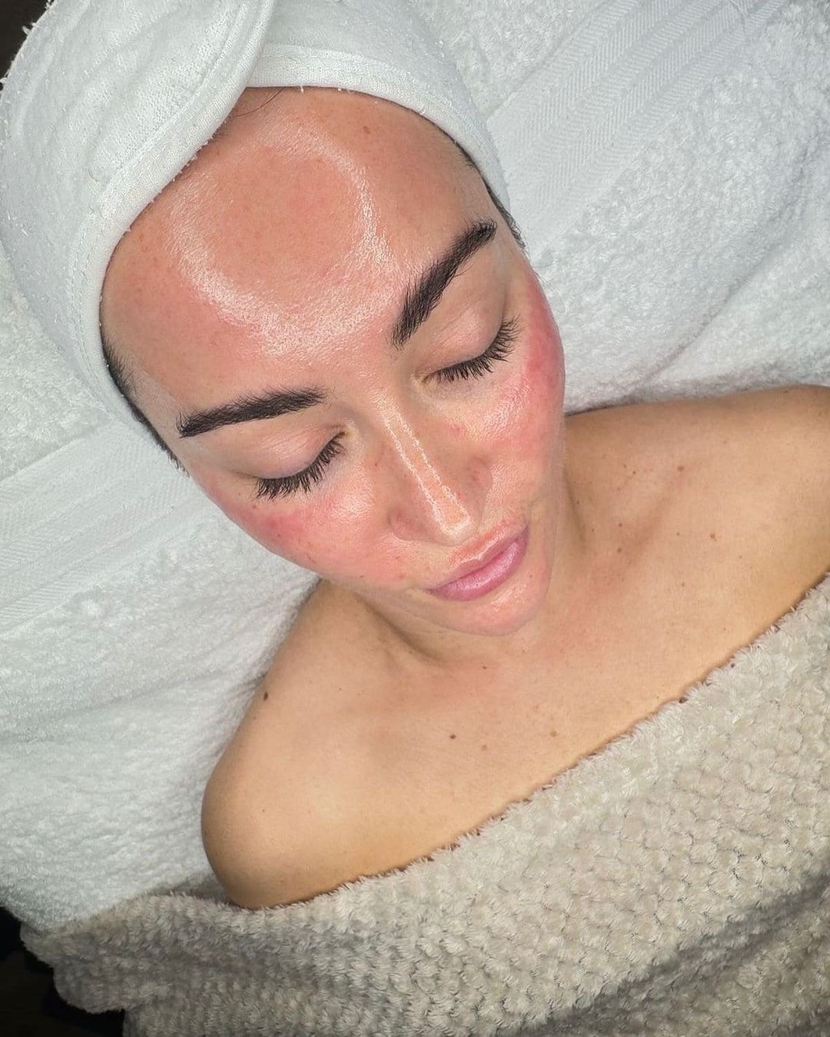 Tratamiento Hydrodiamond 