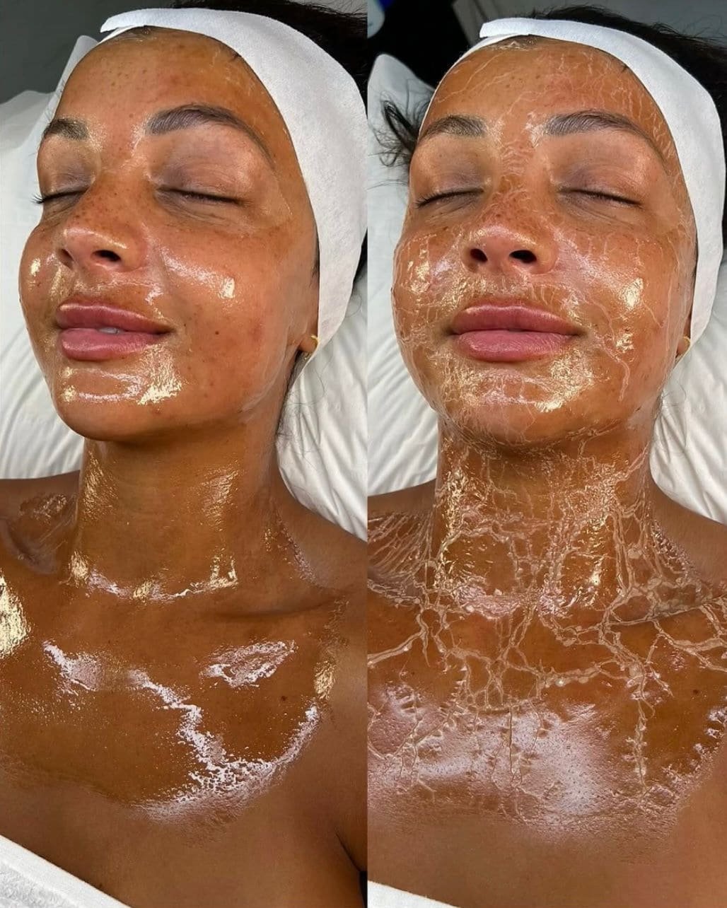 Mascarilla reafirmante de Peptidos