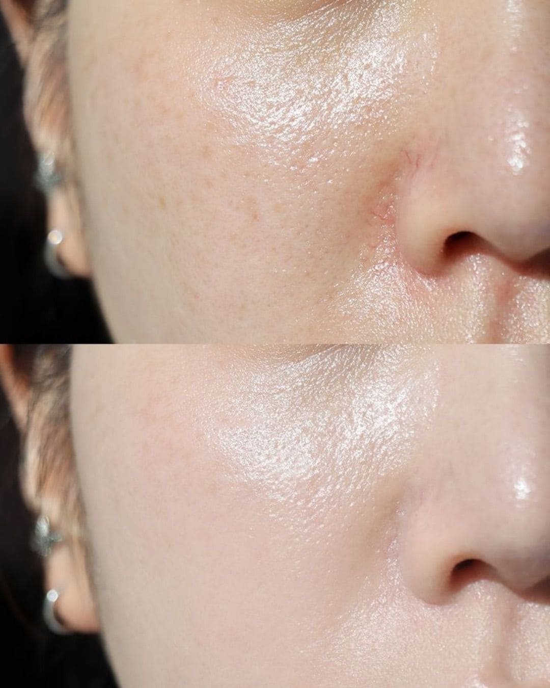 Tratamiento Hydrodiamond 