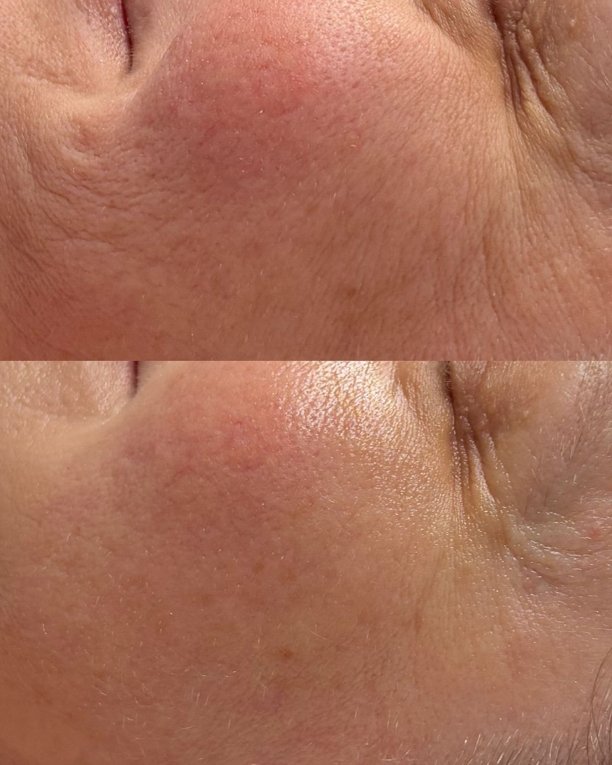 Tratamiento Swich Circadia