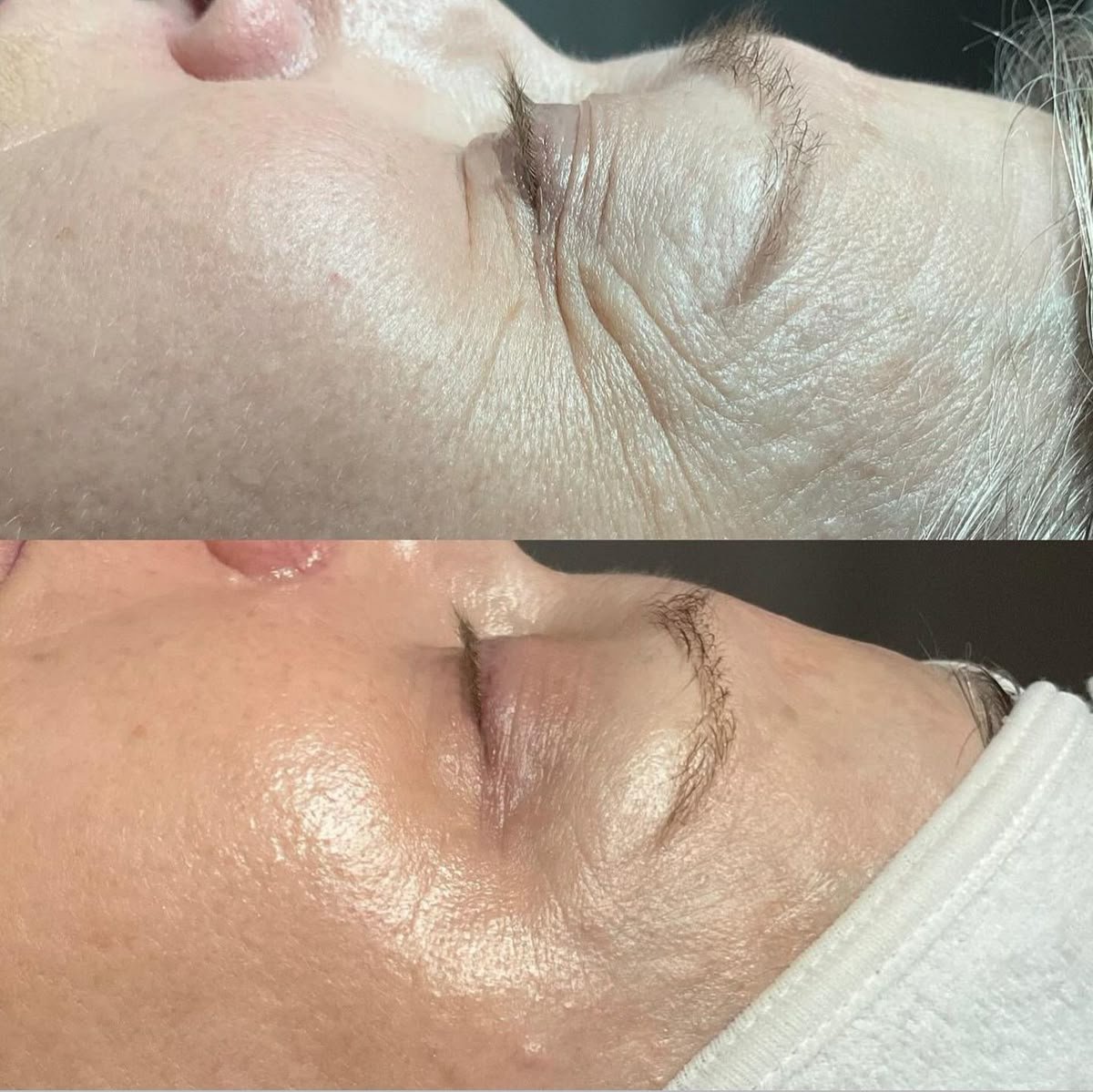 Tratamiento Swich Circadia